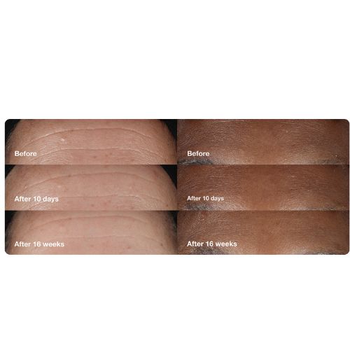 Clinique Smart Wrinkle Repair Serum