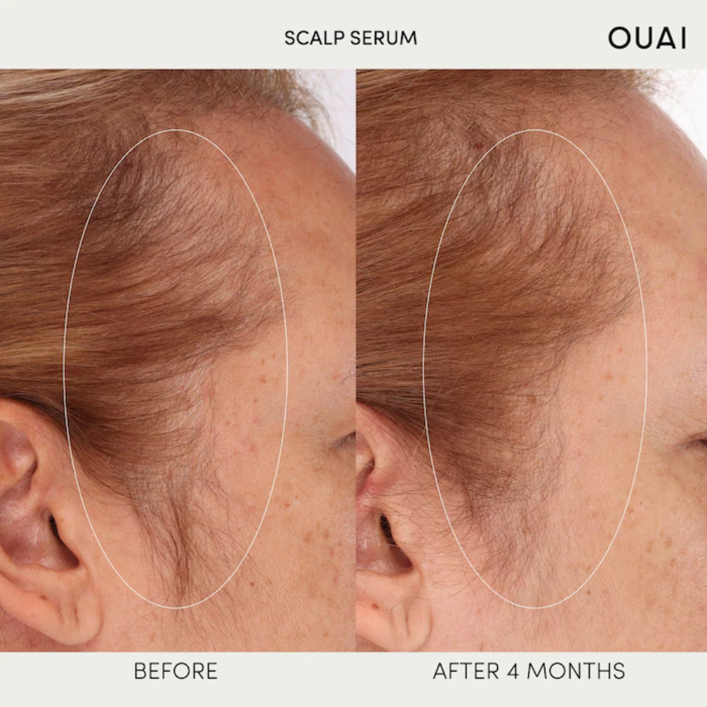 Ouai Scalp Serum